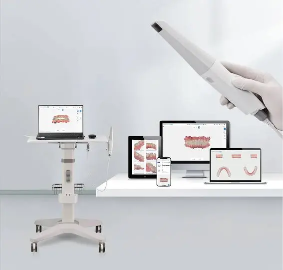 3d_intraoral_scanner4.webp