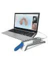 3d_intraoral_scanner1.webp
