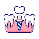 Implantology